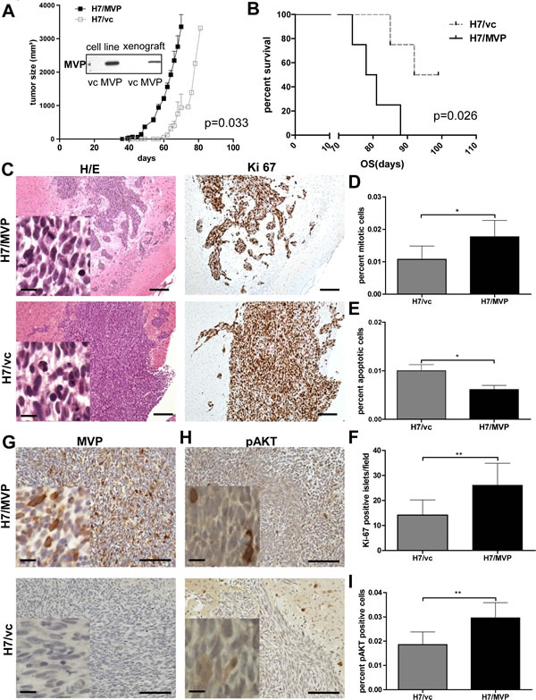 MVP supports GBM xenograft growth and invasiveness.