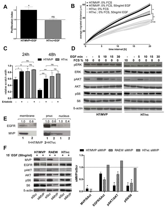 The EGF/EGFR signalling module is involved in MVP-mediated GBM cell survival, migration and PI3K pathway upregulation.