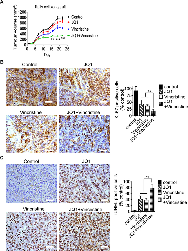 JQ1 and vincristine synergistically suppress neuroblastoma progression in neuroblastoma-bearing mice.