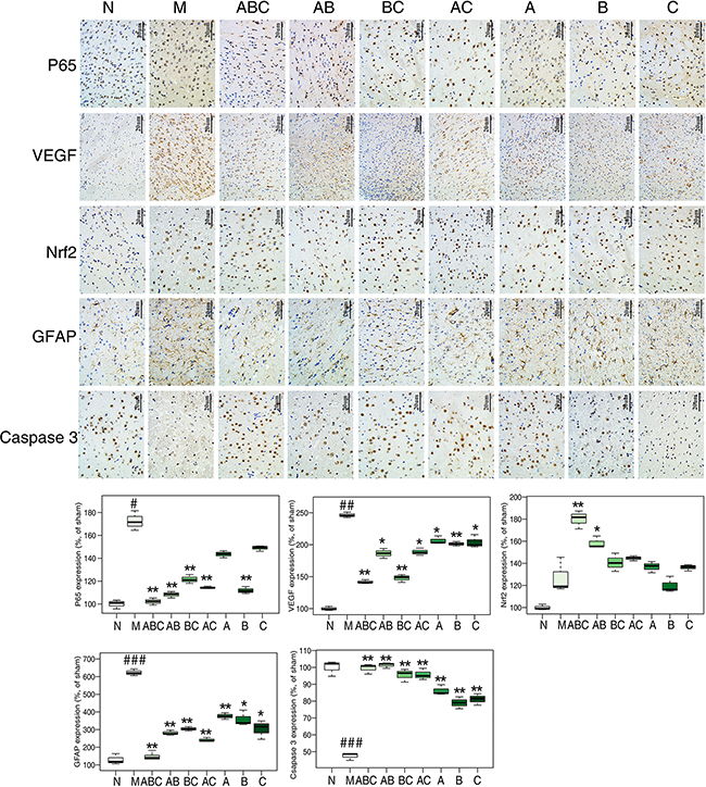 Proteins expression determined by immunohistochemical staining.