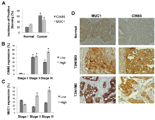 CIN85 and MUC1 are overexpressed in advanced stages of breast cancer.