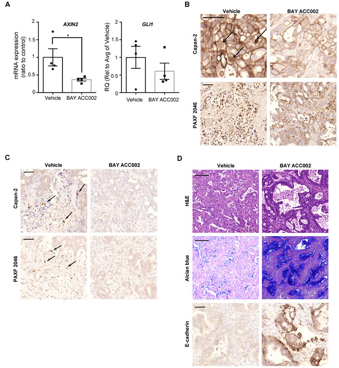 BAY ACC002 Decreases WNT and HH Signaling in Pancreatic Cancer Models