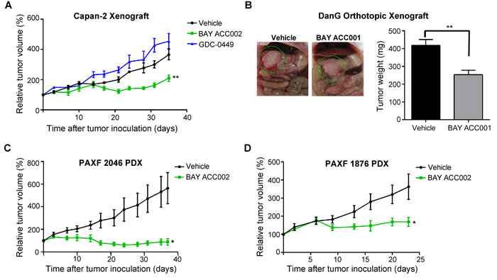 Sensitivity of Pancreatic Tumors to ACC Inhibition