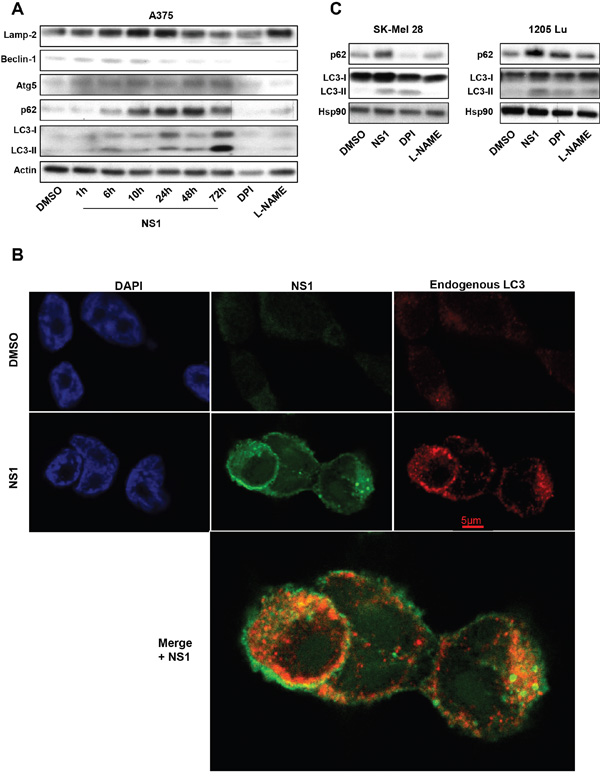 Effect of NS1 on autophagy: A375 melanoma cells A. or other melanoma cells B. were treated by 30&#x03BC;M NS1 or 30&#x03BC;M DPI or 100 &#x03BC;M L-NAME at indicated time.