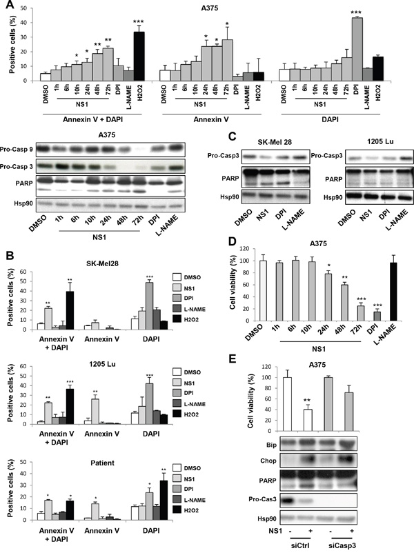 Evidence for apoptosis of melanoma cells treated by 30 &#x03BC;M NS1.