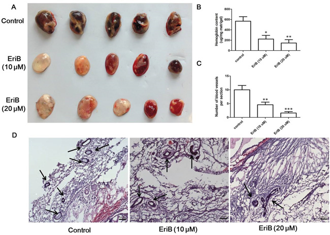 EriB-mediated anti-angiogenesis effect in Matrigel plug assay.