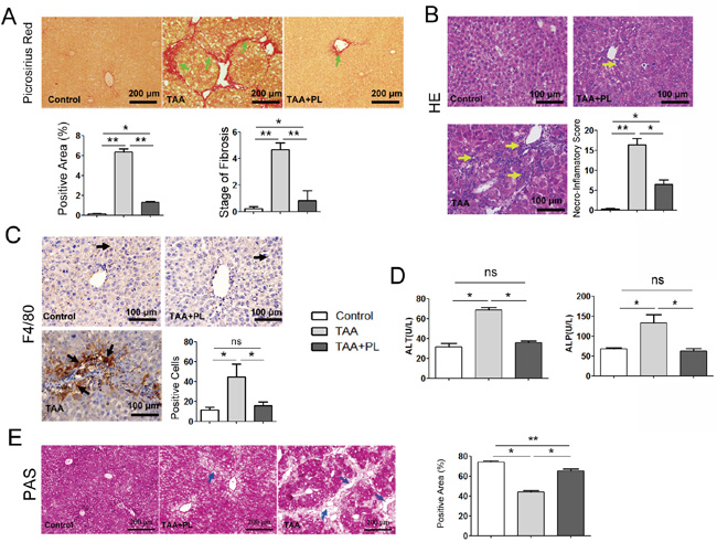 Plumbagin suppressed TAA-induced collagen deposition, inflammatory cell infiltration, and liver function abnormalities in a chronic liver damage model.