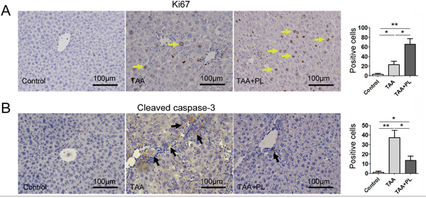 Plumbagin enhanced hepatocellular proliferation and inhibited hepatocellular apoptosis in a chronic liver fibrosis model.