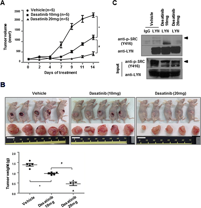 Dasatinib inhibits the growth of LYN-positive lung ADC xenografts.