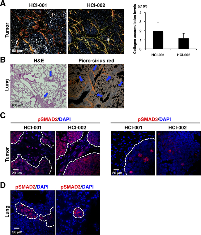 PDX models of TNBC exhibit enhanced collagen accumulation, activated TGF-&#x03B2; signaling and lung metastasis.