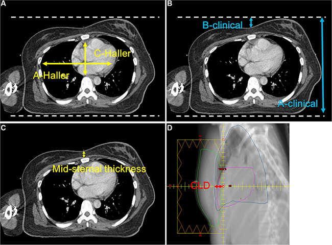 Anatomical parameters.