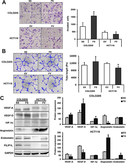 FILIP1L inhibits angiogenesis in human colorectal cancer cells.