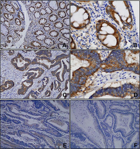 Representative images of immunohistochemical staining of FILIP1L.