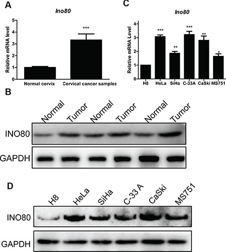 Ino80 is highly expressed in cervical cancer.