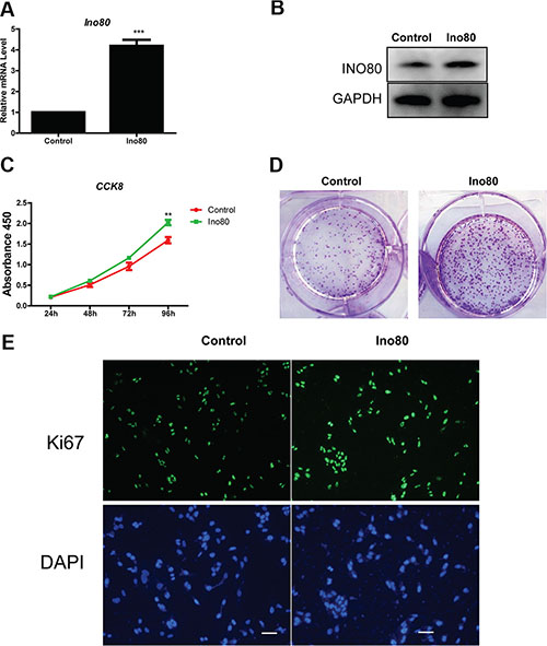 Ino80 overexpression promotes cervical epithelial cell proliferation.