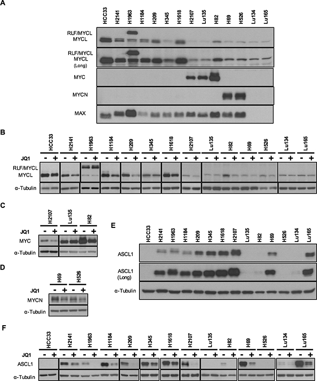 Expression of MYC family and ASCL1 proteins and their reduction by JQ1 in SCLC cell lines.