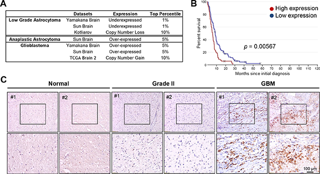Lon is over-expressed in human malignant gliomas.