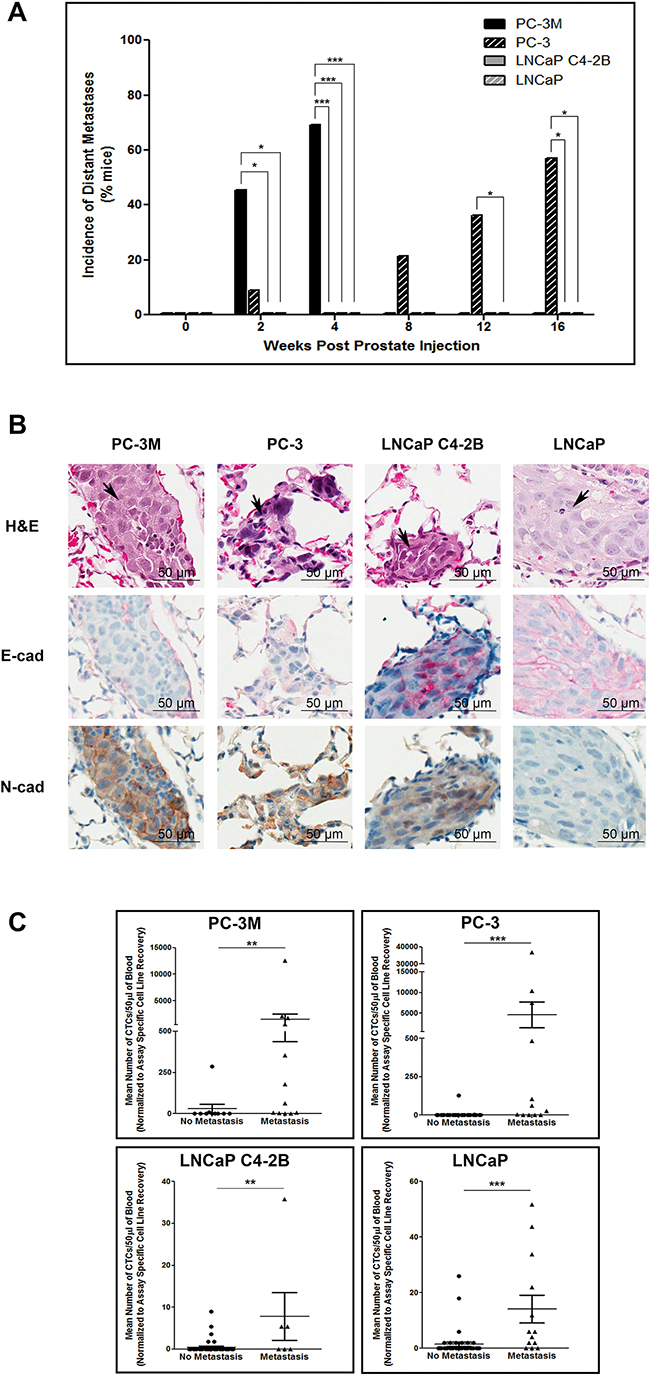 Mesenchymal human prostate cancer cell lines exhibit an enhanced capacity for metastasis that is correlated with CTC dissemination.