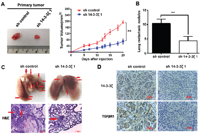 Knockdown of 14-3-3&#x03B6; suppressed tumor growth and decreases the formation of metastases in vivo.