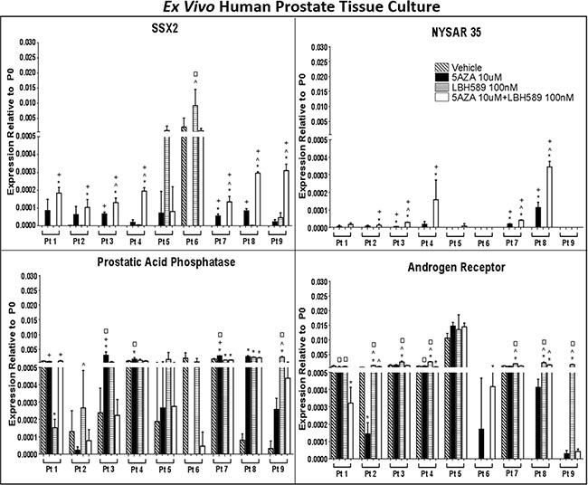 EMA treatment induces CTA expression in ex vivo human prostate tissue in a prostate biopsy drug culture model.