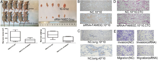 In vivo, FAM83D knockdown inhibited the tumorigenicity, and FAM83D-siRNA transfected SMMC-7721 cells presented an apparent decrease in tumor size and weight comparing the control cells A.