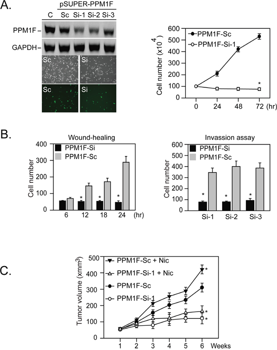 Knockdown of PPM1F expression inhibits human breast cancer cell proliferation, migration, and in vivo tumor growth.