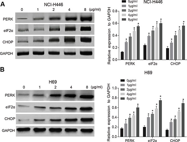 Effects of different doses of tunicamycin on the activation of endoplasmic reticulum stress (ERS) in NCI-H446 and H69 cells.