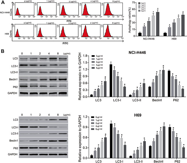 Effects of different doses of tunicamycin on the autophagy of NCI-H446 and H69 cells.
