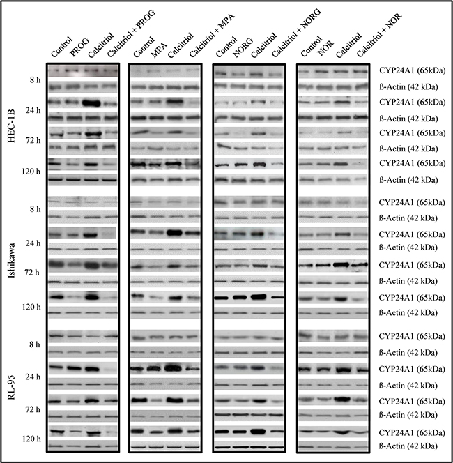 Immunoblot analysis of CYP24A1 protein levels in HEC-1B, Ishikawa, and RL-95 cells after treatment with vehicle (control), progesterone (PROG), medroxyprogesterone (MPA), norgestrel (NORG), or norethindrone (NOR) alone or in combination with calcitriol for 8, 24, 72 or 120 h.