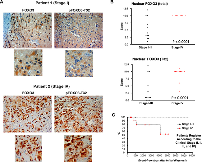 Expression analyses of NB tumor tissue reveals correlation between nuclear, T32-phosphorylated FOXO3, stage IV disease and adverse clinical outcome.