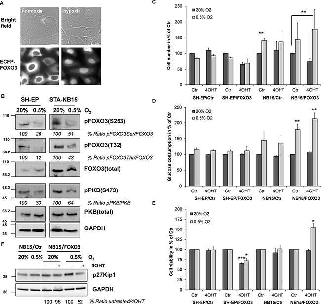 Hypoxia reduces the activity of the PKB survival pathway, causes nuclear accumulation of FOXO3 and promotes growth of high-stage STA-NB15 cells.