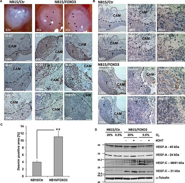 NB15/FOXO3-derived tumors exhibit increased vessel formation in chorioallantoic membrane (CAM) assays.