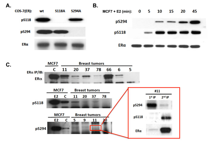 Specific immunoreactivity of pS294, its induction kinetics relative to pS118 in an ER-positive breast cancer cell line (MCF7), and the variable expression of endogenous pS294 found in ER-positive human breast tumors.