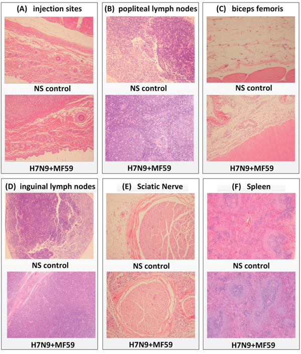 At day 32 (dosing phase) of the repeated dose toxicity test, H&#x0026;E staining was performed of various organs from rats treated with H7N9 vaccine with MF59 adjuvant or NS control.