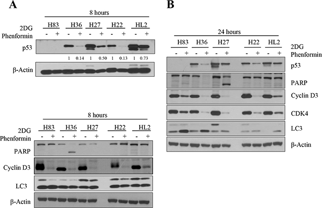Protein expression was analyzed after p53 mutant cells were treated with 2-DG and phenformin.