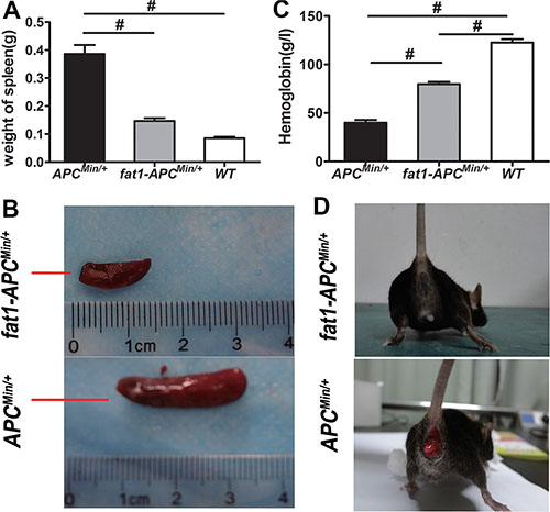 Anemia is ameliorated and rectal prolapse is prevented in fat-1-APCMin/+ mice compared with APCMin/+ mice.