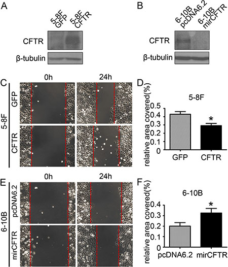 CFTR affects NPC cell migration.