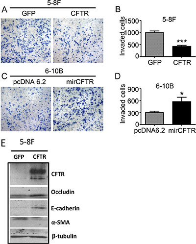 CFTR regulates NPC cell invasion.
