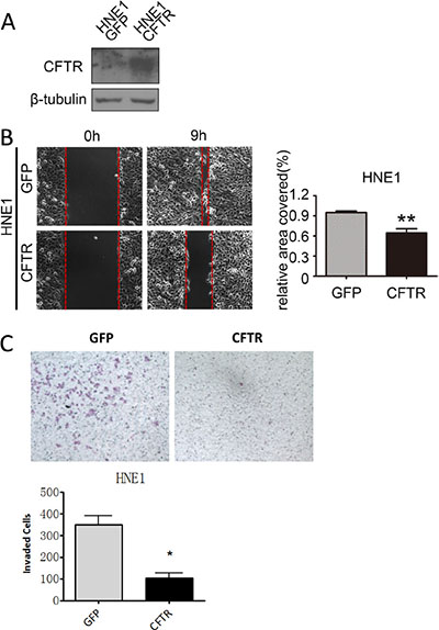CFTR regulates cell migration and invasion in HNE1 cells.