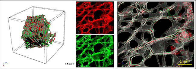 Overview of the study by micro-CT analysis: human femoral head bone specimens were scanned at T0 and T1 and 4D micro-CT analyses was applied to identify regions of bone formation (green) and resorption (red).