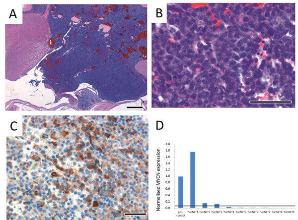Immunohistochemistry of brain tumors in LSL-MYCN;hGFAP-Cre mice confirmed their neuroendocrine origin.