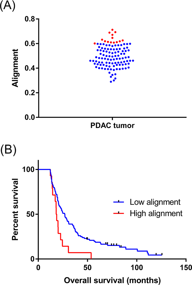 Collagen alignment significantly varies between individual PDAC tumors.