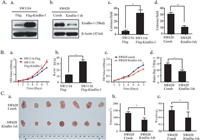 Kindlin-1 promotes CRC cell proliferation in vitro and tumor growth in vivo.