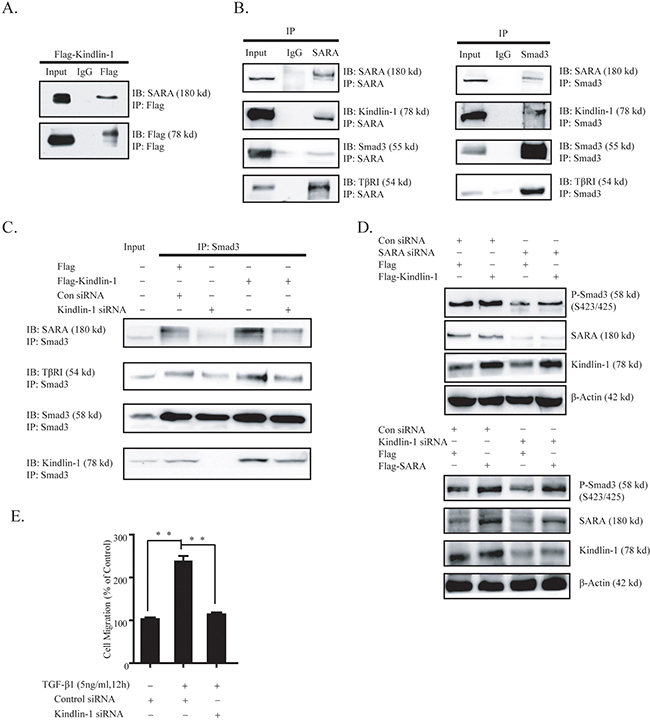 Kindlin-1 forms a complex with SARA, T&#x03B2;RI and Smad3 to activate TGF-&#x03B2;/Smad3 signaling in CRC cells.