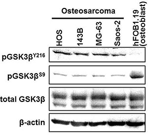 Expression and phosphorylation of GSK3&#x03B2; in osteosarcoma cells and in untransformed osteoblasts.