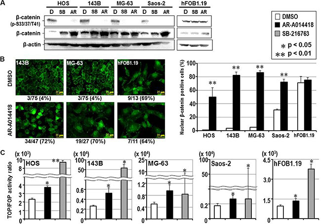 Effect of GSK-3&#x03B2; inhibition on the expression, phosphorylation, subcellular localization and co-transcriptional activity of &#x03B2;-catenin in osteosarcoma and osteoblast cells.