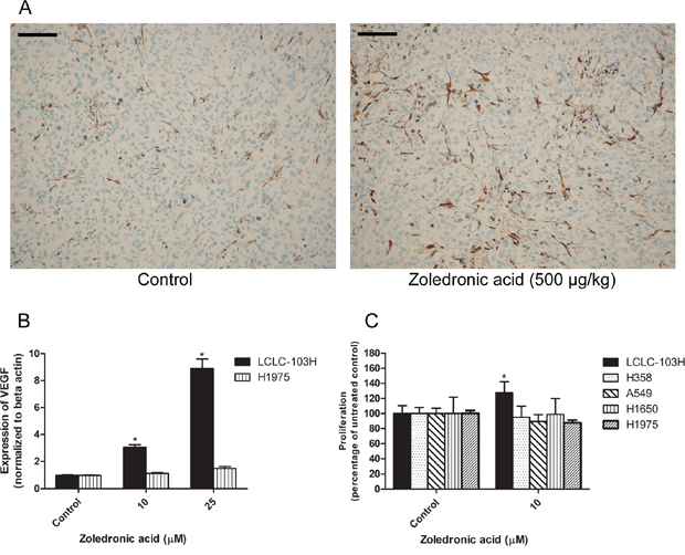 The effect of zoledronic acid on the in vivo vascularization of LCLC-103H xenograft and the in vitro modelling of this phenomenon.