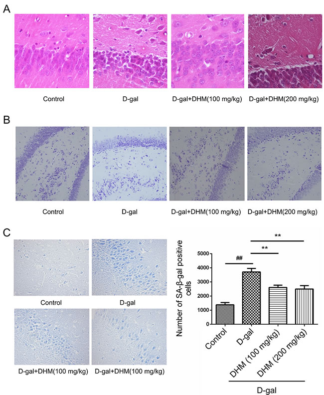 Representative photomicrographs showing histopathological changes in hippocampus tissues with