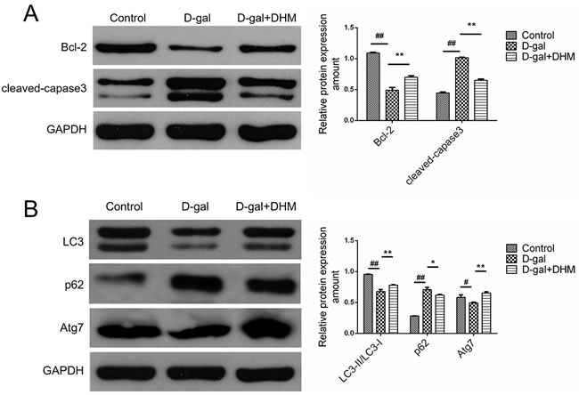 DHM attenuated the excessive apoptosis and rescued the deficient autophagy in hippocampus tissues of D-gal-induced aging rats.