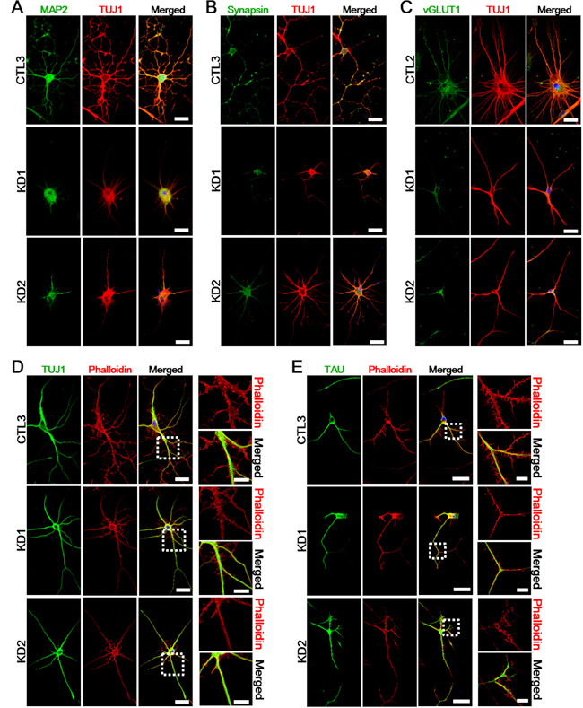 Defects of neuritic properties in KD iNeurons.